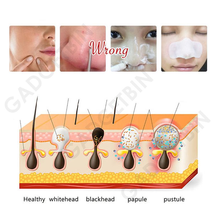  photo HM9001 Clean 7_zpsvbxxqfds.jpg