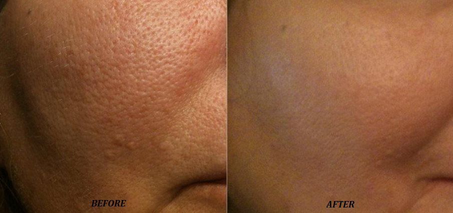  photo 4_zpsb0c9c35c.jpg